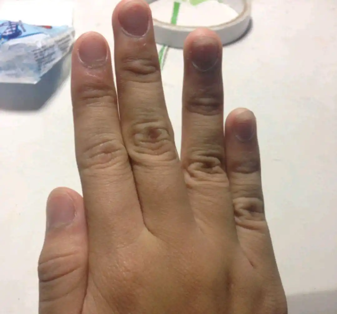 想要身体健康_想要身体健康应该怎么做_想要身体健康的基础是什么